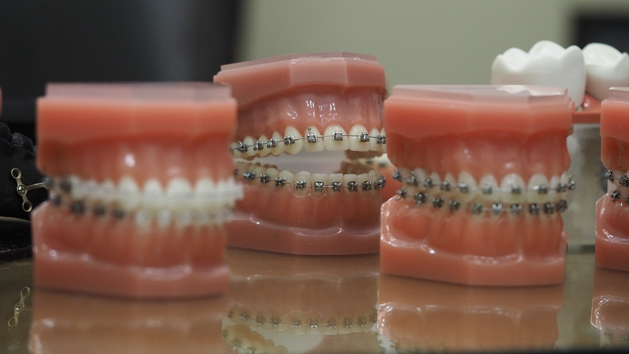 ortodoncias_brackets