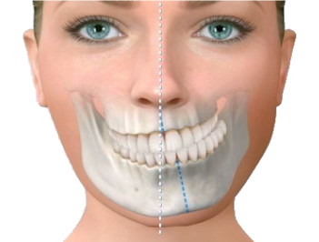 asimetria-facial-sevilla