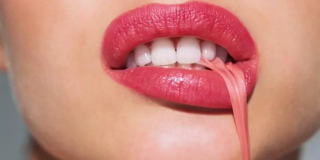 chicles-implante-dental