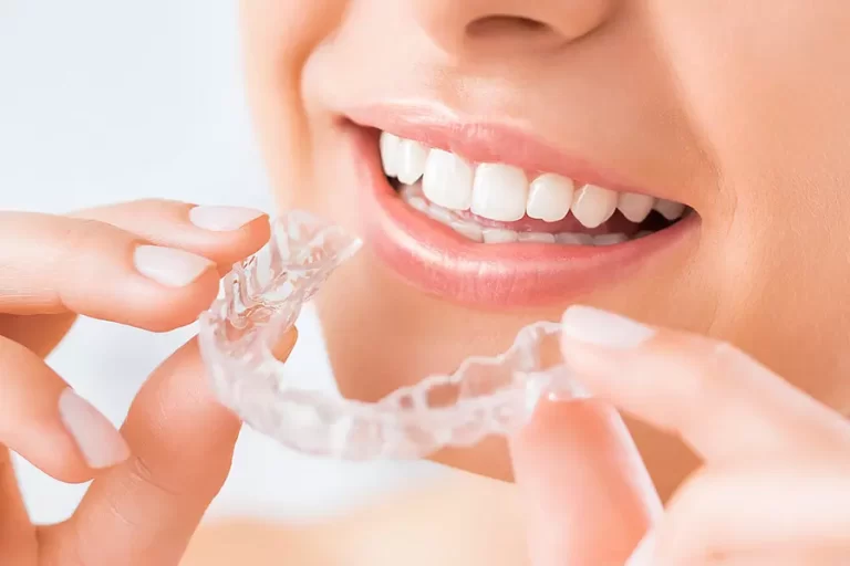 fases-tratamiento-invisalign