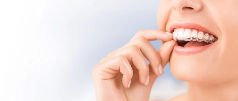 Efectos secundarios Invisalign ¿Existen?