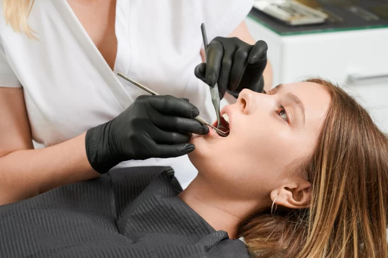 Empaste dental: Qué es, cuándo es necesario y cuánto dura