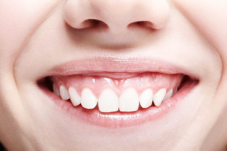 portada gingivectomia