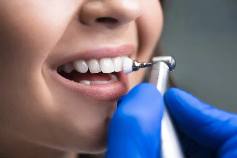 portada-limpieza-dental